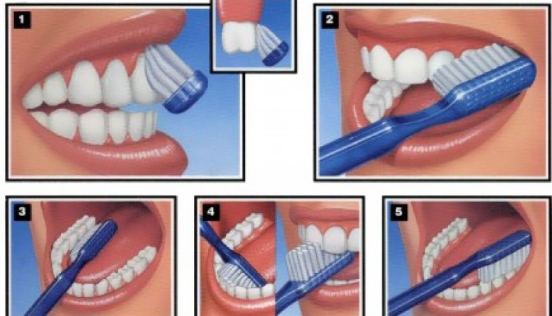 Как правильно чистить зубы