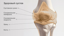 Зачем суставам гиалуроновая кислота?